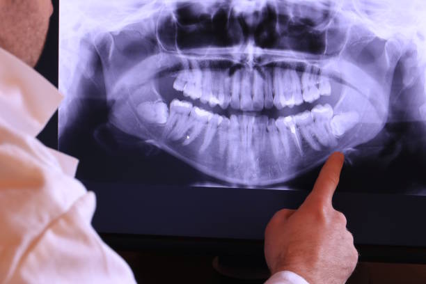 Best Emergency Treatment for Dental Infections or Abscesses in Walnut Grove, GA