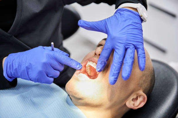 Best Emergency Tooth Extraction in Walnut Grove, GA